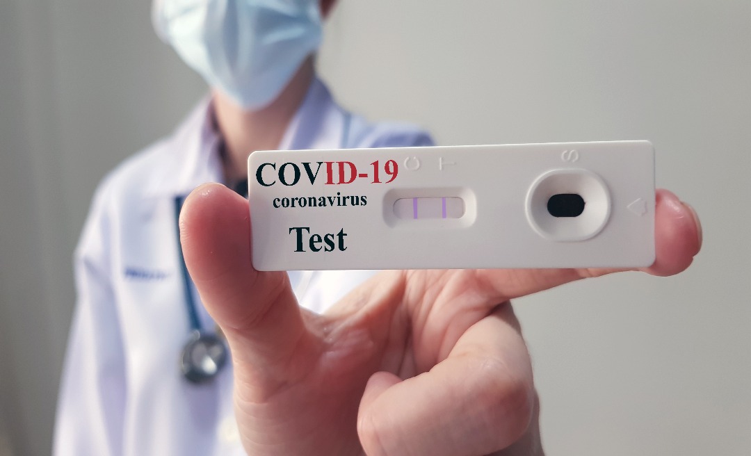 Mais 376 novos casos de covid-19 são registrados nesta sexta-feira